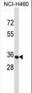 OR14C36 / OR5BF1 Antibody (aa284-312)