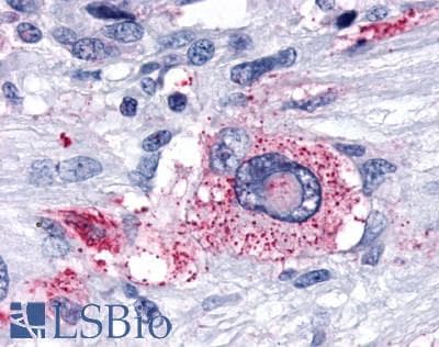 PathPlus™ Polyclonal Rabbit anti-Human OPRD1 / Delta Opioid Receptor Antibody (N-Terminus, IHC)