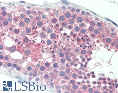 IHC-plus™ LAPTM4B Antibody (aa195-209)