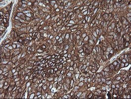 MAP2K1 / MKK1 / MEK1 Antibody (clone OTI2D4, Carrier-free)