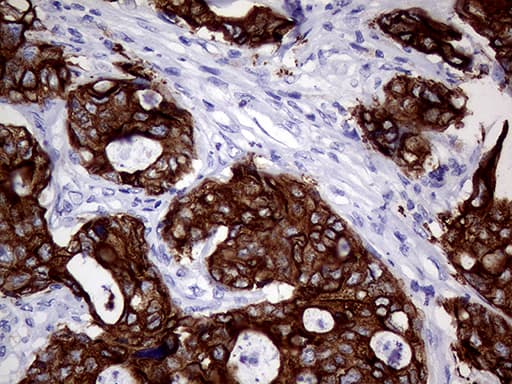 AGR2 Antibody (aa21-175, clone OTI1H8)