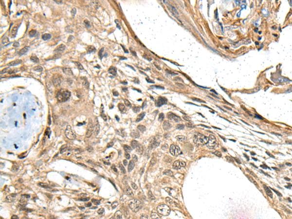 Polyclonal Rabbit anti-Human MAPK4 / ERK4 Antibody (IHC, WB)