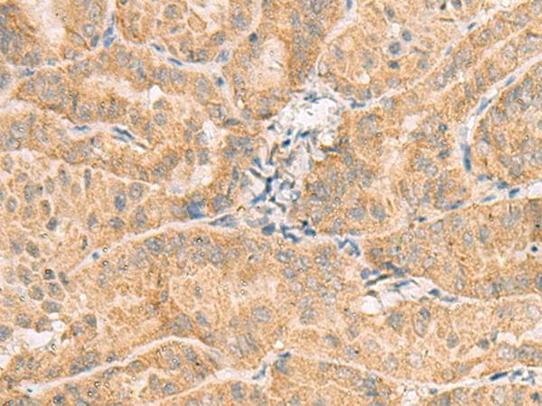 ARA70 / NCOA4 Antibody