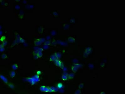 Polyclonal Rabbit anti-Human TMEM59L Antibody (IHC, WB)