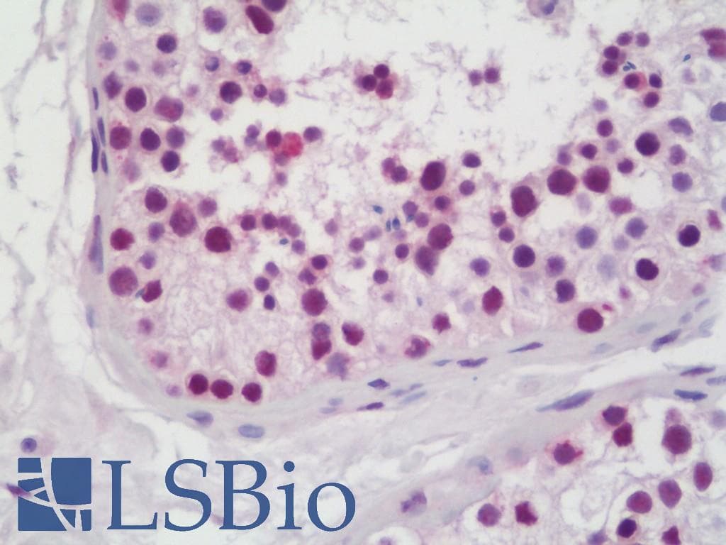 IHC-plus™ MTA1 Antibody (aa400-450)