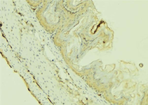IL36B Antibody