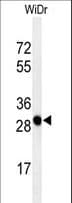 PAQR3 Antibody (aa242-270)