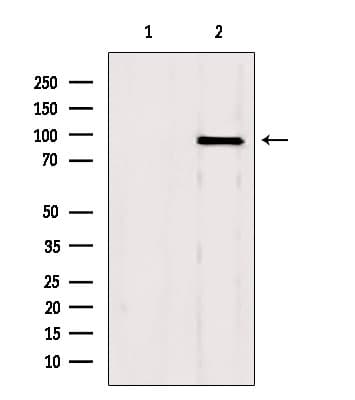 GSN / Gelsolin Antibody