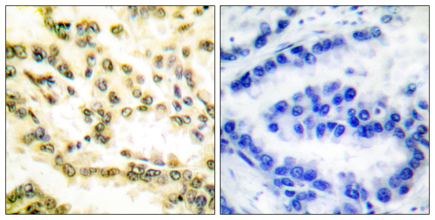 LMNA / Lamin A+C Antibody (Cleaved-Asp230)