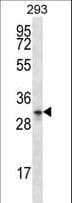 GPM6A / Glycoprotein M6A Antibody (aa246-275)