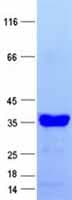 Human WFDC2 / HE4 Protein (Recombinant TRX-His, N-terminus)