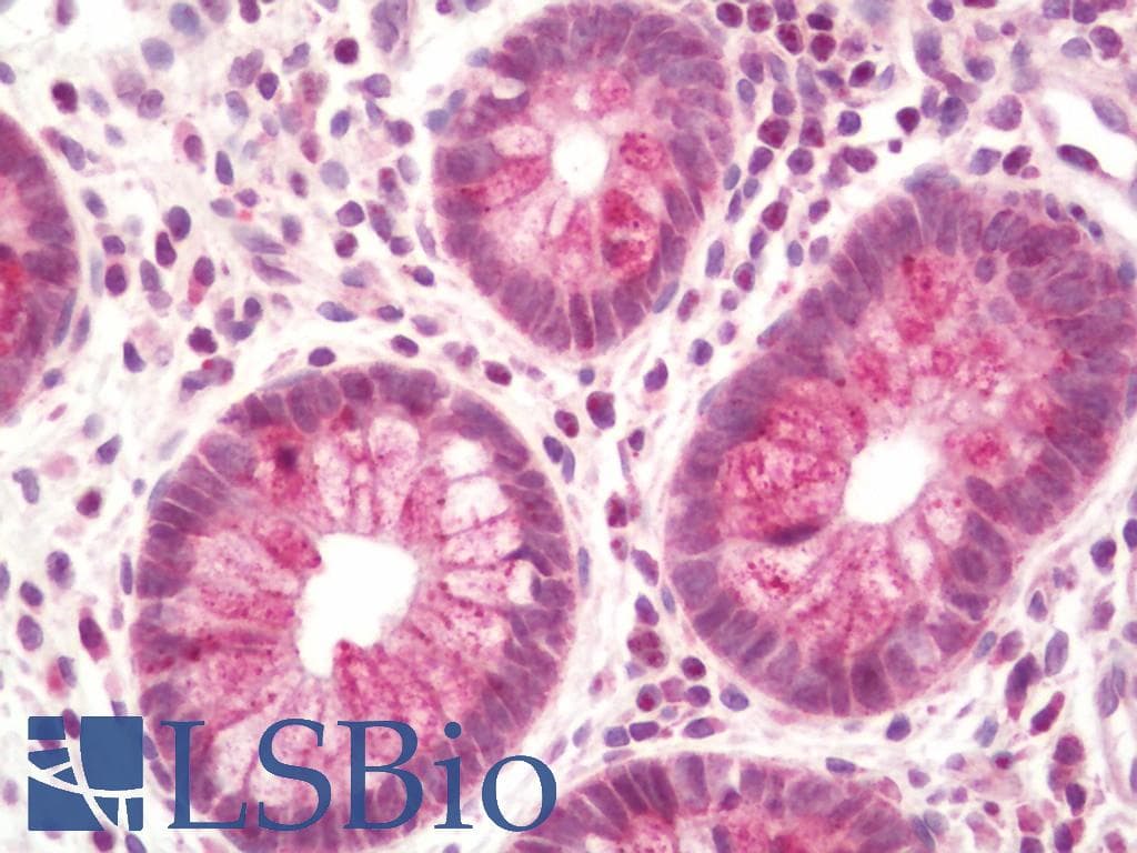 IHC-plus™ NUP210 / gp210 Antibody