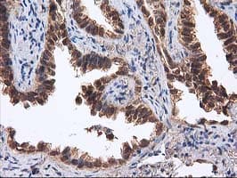 DSTN / Destrin Antibody (clone OTI2C10)