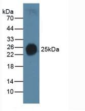 SFTPC / Surfactant Protein C Antibody (aa24-197, PE)