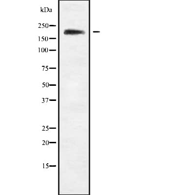 SCN9A / Nav1.7 Antibody