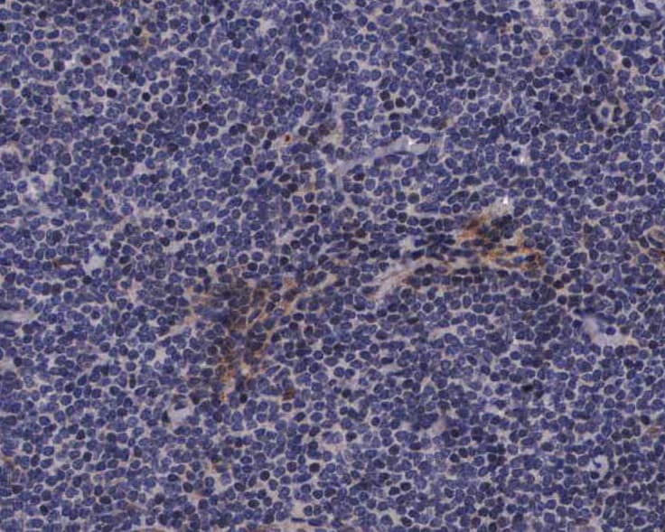 CALD1 / Caldesmon Antibody (phospho-Ser789)