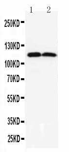 ANO1 / DOG1 / TMEM16A Antibody (aa927-943)
