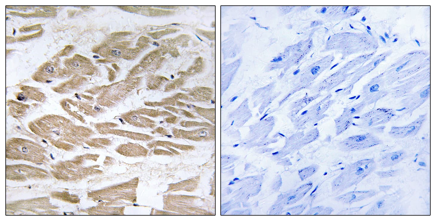 Polyclonal Rabbit anti-Human BRP44L Antibody (aa11-60, IHC, IF, WB)