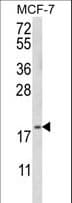 GABARAPL2 / ATG8 Antibody