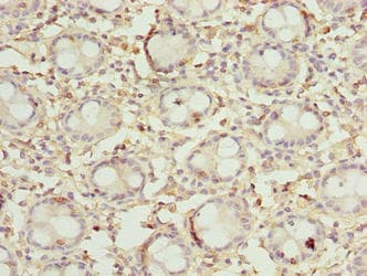 DENND5A Antibody