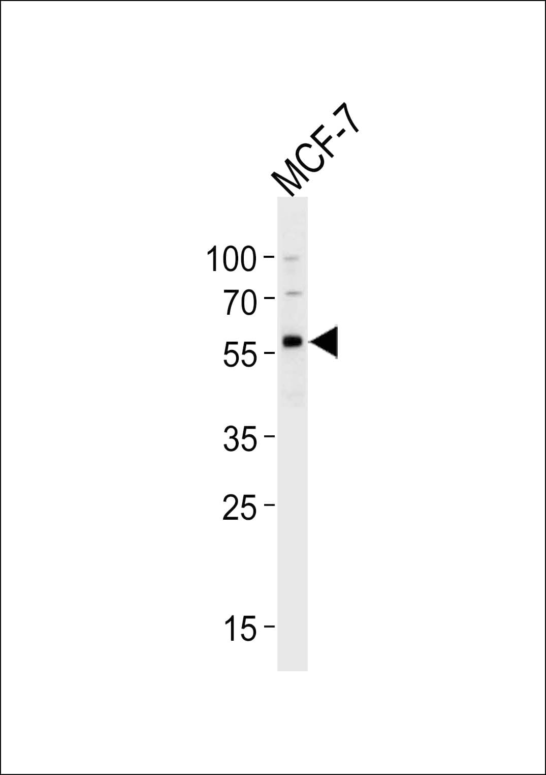 OCLN / Occludin Antibody (aa446-474)