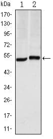 CA9 / Carbonic Anhydrase IX Antibody (clone 2D3)