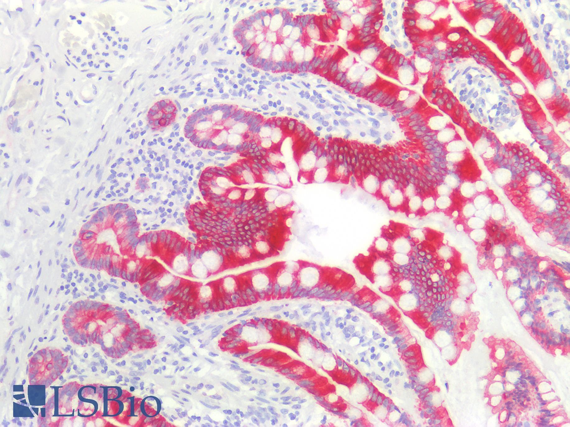 PathPlus™ Monoclonal Mouse anti-Human Cytokeratin AE1+AE3 Antibody (clone AE1+AE3, IHC)