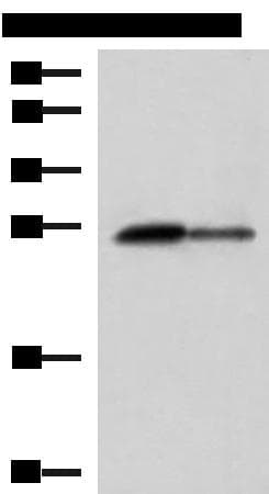 CTRB1 / Chymotrypsinogen B1 Antibody