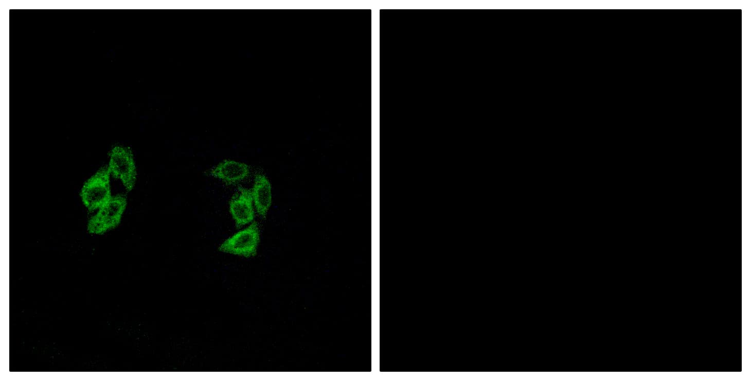 CSNK1A1 + CSNK1A1L Antibody (Internal)