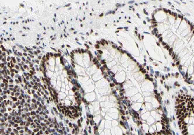 Polyclonal Rabbit anti-Human SAE2 / UBA2 Antibody (IHC, IF, WB)