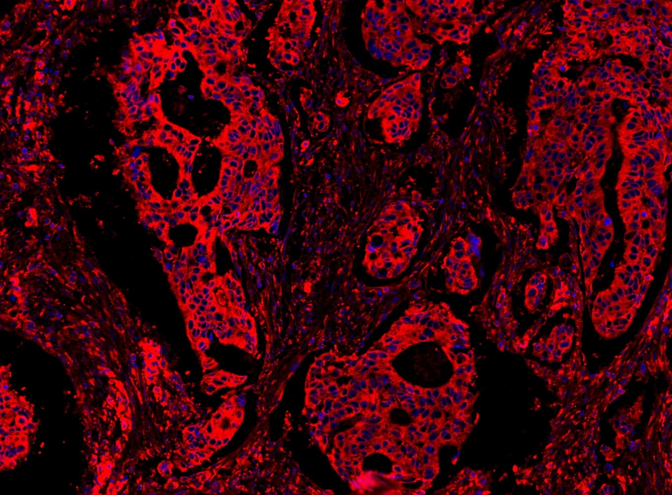 Polyclonal Rabbit anti-Human MYD88 Antibody (aa44-264, IHC, WB)