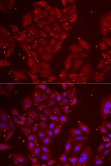 TPP2 Antibody