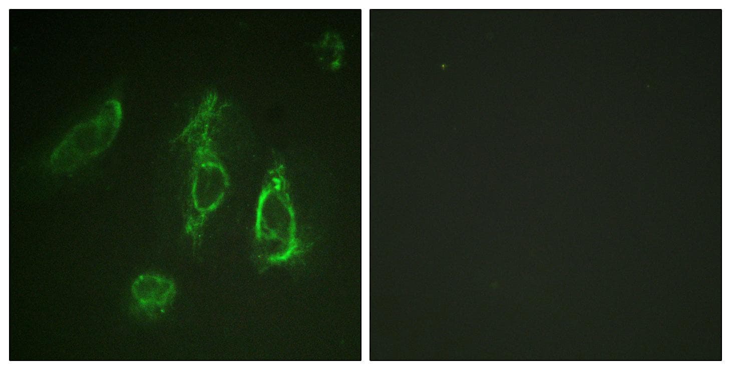Polyclonal Rabbit anti-Human EPOR / EPO Receptor Antibody (p368, IF, WB)