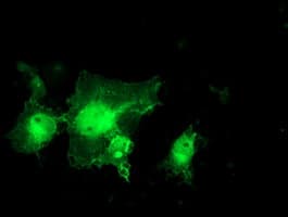 MIF4GD Antibody (clone OTI4C11)