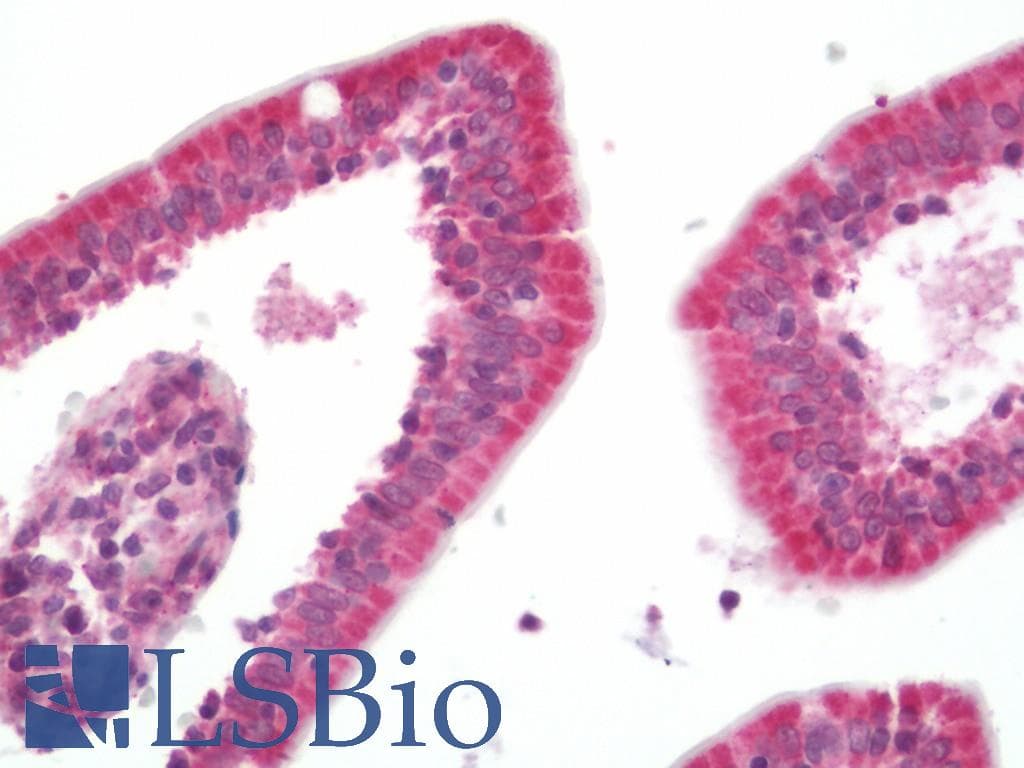 IHC-plus™ TXNIP Antibody