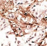 Polyclonal Rabbit anti-Human MAP1LC3C / LC3C Antibody (aa1-30, IHC, WB)