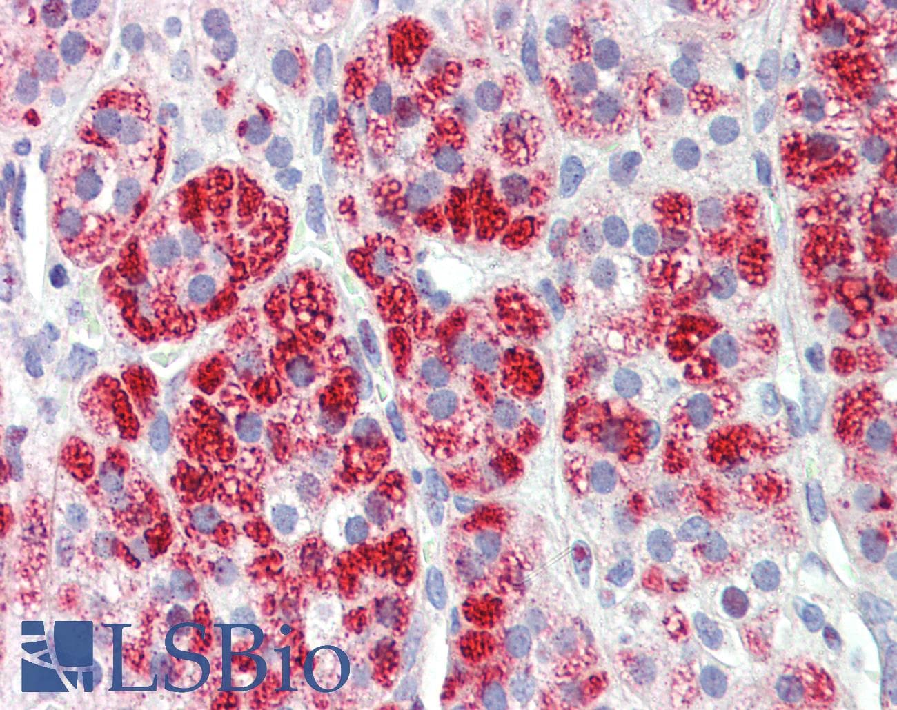 IHC-plus™ Polyclonal Goat anti-Human CLTC / Clathrin Heavy Chain Antibody (aa1617-1630, IHC)