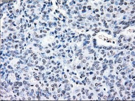 CRYAB / Alpha B Crystallin Antibody (clone OTI6G5)