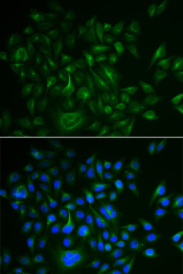 BAMBI Antibody