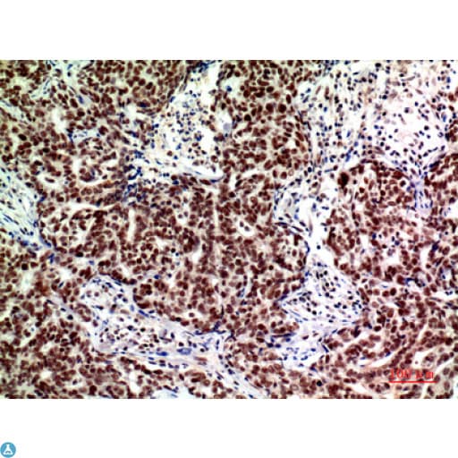 ACER2 Antibody