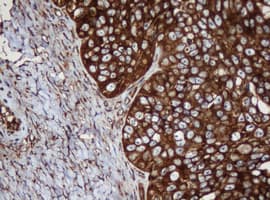 PAI-RBP1 / SERBP1 Antibody (clone OTI5G2)