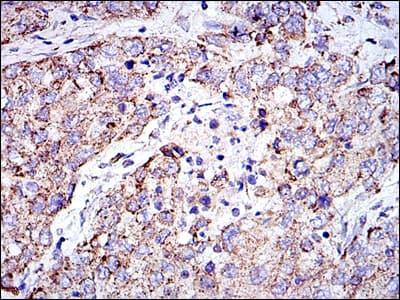 IHC-plus™ PHB / Prohibitin Antibody (clone 5H7)