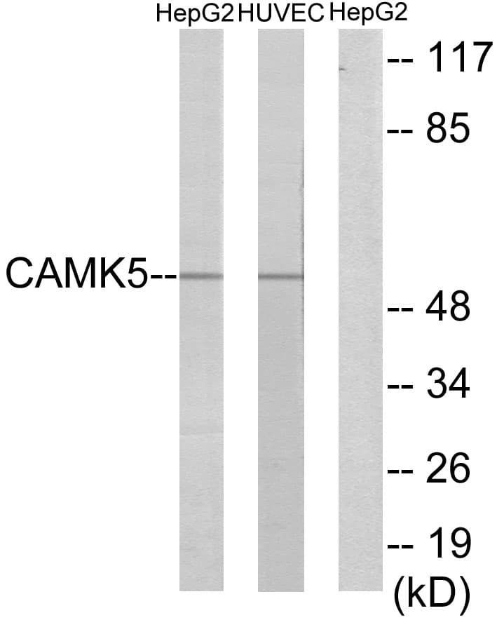 IHC-plus™ CAMKV Antibody (aa211-260)