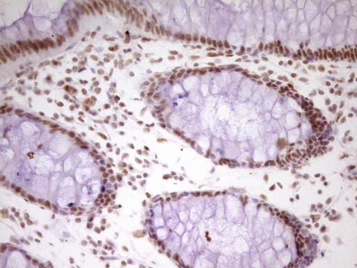 HMG20A Antibody (aa1-281, clone OTI2H4)