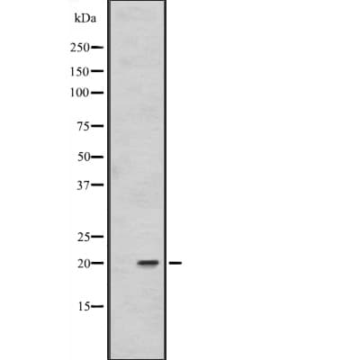 Polyclonal Rabbit anti-Human FAIM Antibody (IHC, WB)