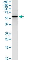 IHC-plus™ NEU1 / NEU Antibody (clone 3F9)