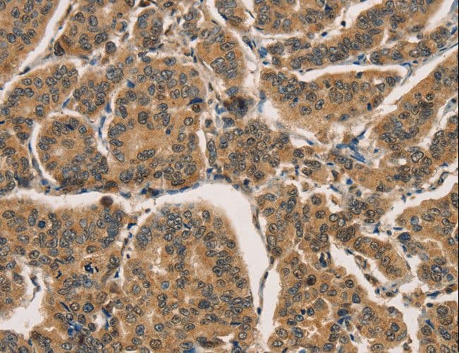 CTNNBIP1 / ICAT Antibody