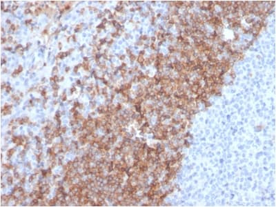 IGHD Antibody (clone IGHD/2730R)