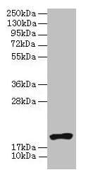 Polyclonal Rabbit anti-Human NR2C2AP / TRA16 Antibody (IHC, WB)