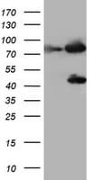 F13A1 / Factor XIIIa Antibody (clone OTI9E8)